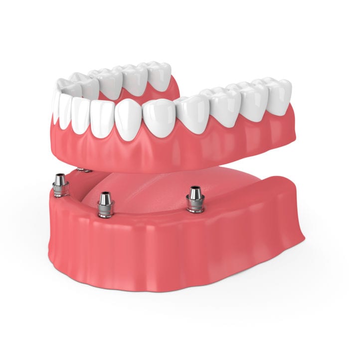 Restore Teeth in Lititz, Pennsylvania