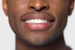 dental implants in Lititz, PA