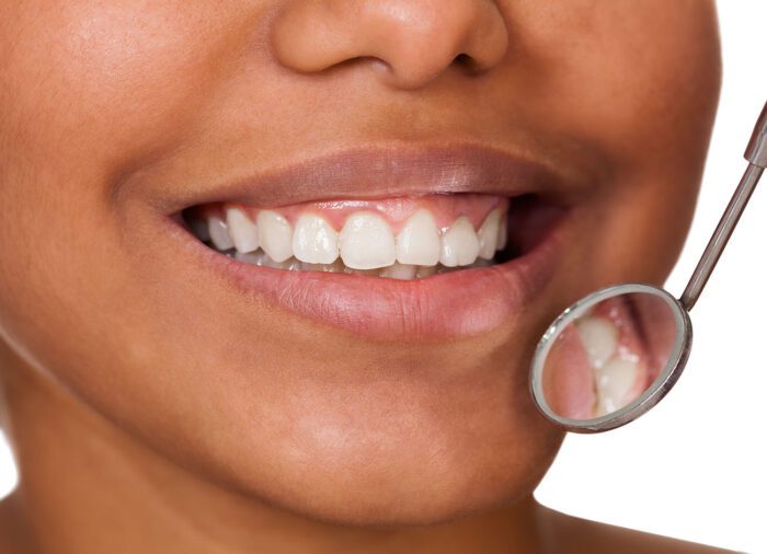 Gum disease in Lititz, PA, affects more than just your smile.