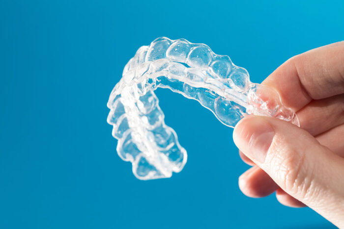 Not everyone qualifies for Invisalign treatment. Understanding the eligibility requirements helps in making an informed decision.
